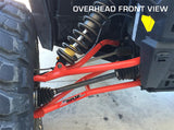 Polaris RZR XP 1000 Forward A-Arm Kit (2014-2016)